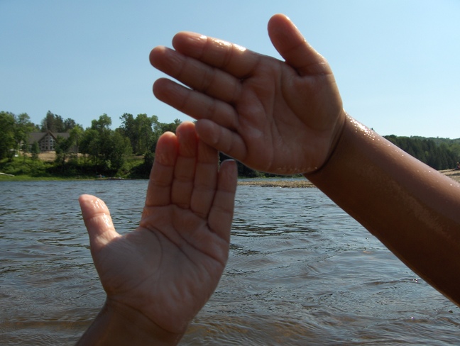 Five & Six Year Olds Wrinkled Hand From Swimming 3 Hours # Sauble River Beach Ma Massey, Ontario Canada