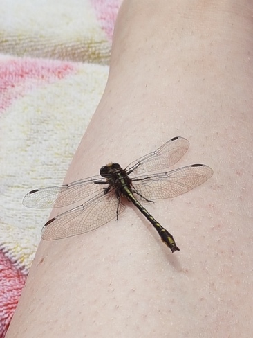 Dragonfly relaxing on my leg Windy Lake, ON